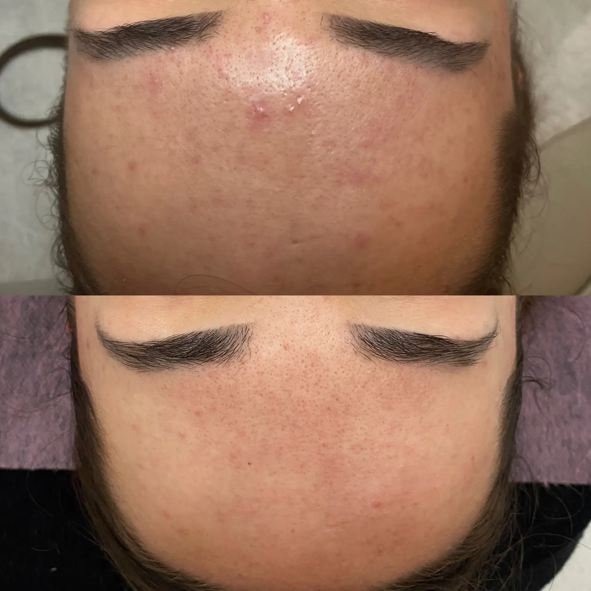 Terapia kosmetologiczna transformacja skóry Płock