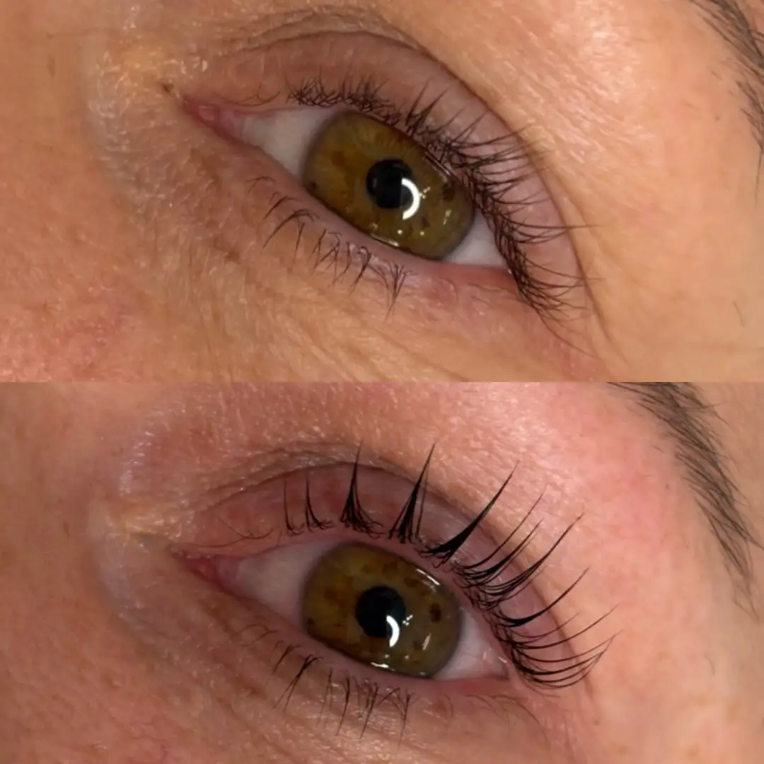 Terapia skóry redukcja niedoskonałości Płock