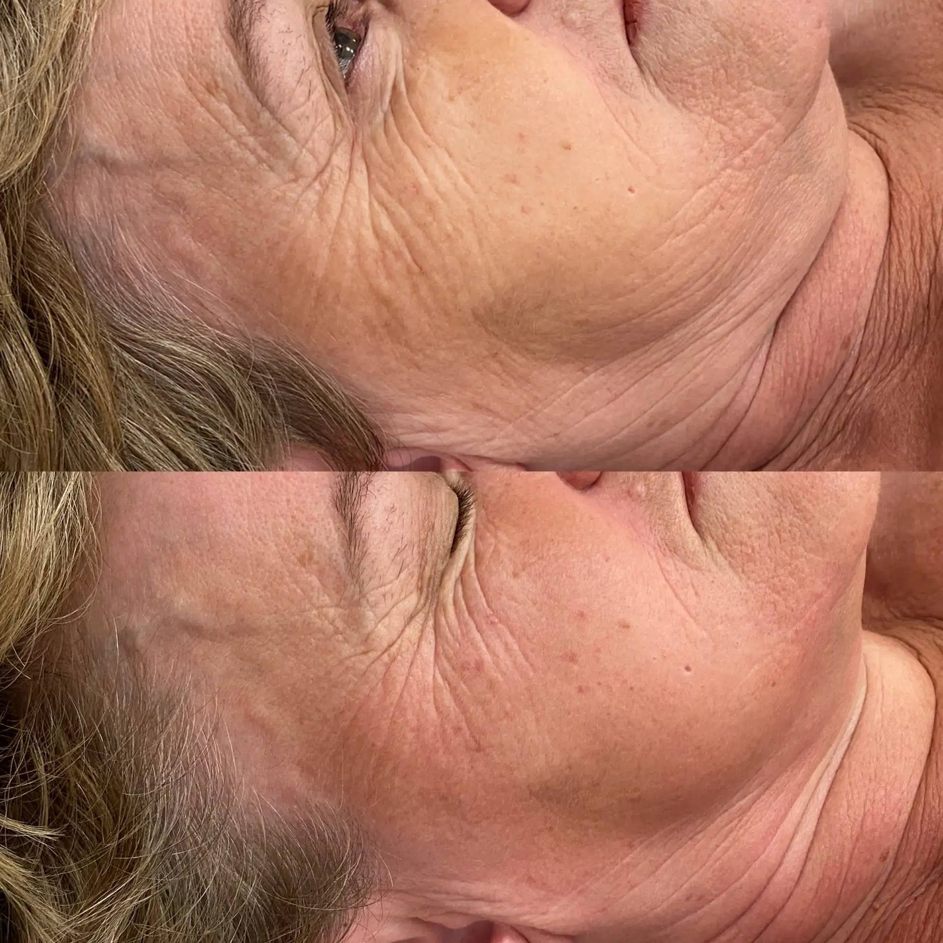 Zabieg profesjonalny kompleksowa pielęgnacja Płock