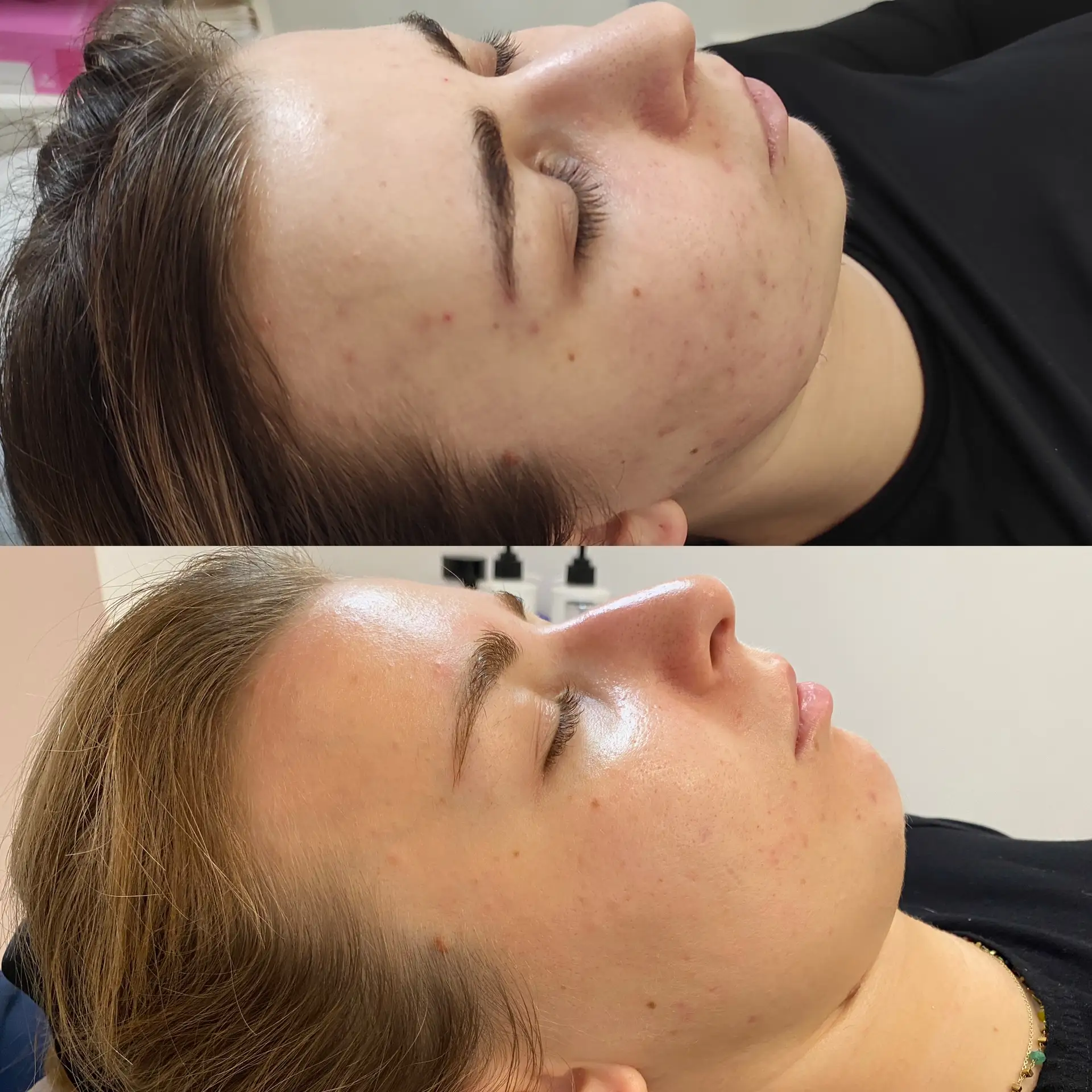 Efekty zabiegu terapeutycznego i regeneracji Płock